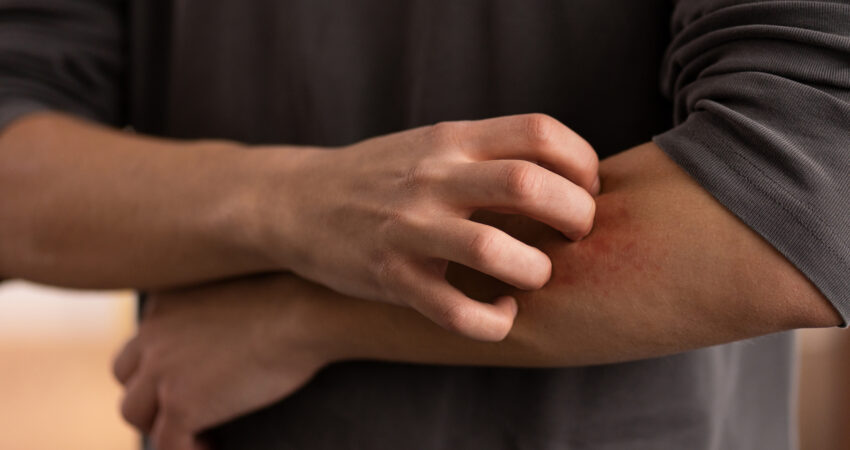 Combate à dengue em condomínios: guia prático para síndicos e moradores